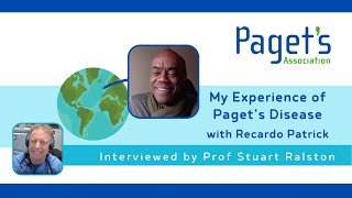 Mr Recardo Patrick explains his experience of Pagets Disease of Bone to Prof Stuart Ralston [upl. by Marcia]