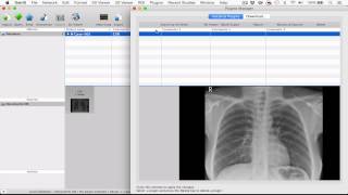 How to install OsiriX plugins [upl. by Humbert]