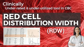 Red cell Distribution Width RDW  What is it and what are its uses [upl. by Adnik759]