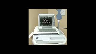 Deltarune  Lancers theme  on a EKG machine [upl. by Draillih]