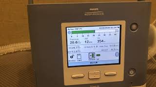 Using Inverse Ratio Ventilation  Philips Trilogy 100 Ventilator [upl. by Rehpinej]