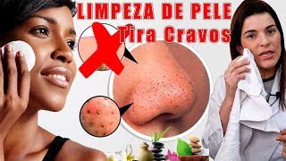 A Melhor LIMPEZA de PELE em Casa  Remove Cravos e deixa a Pele Maravilhosa [upl. by Megan]