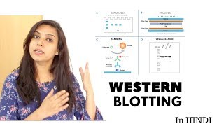 Western blotting technique  Principle  Step by Step  In Hindi [upl. by Forta5]