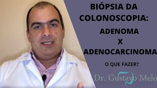 Biópsia da colonoscopia Adenoma x Adenocarcinoma [upl. by Beard]