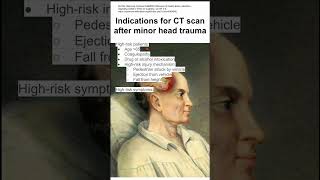 Indications for CT scan after minor head trauma [upl. by Lipson]