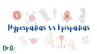 Hypospadias vs Epispadias  embryology MyClinicalBook [upl. by Violet869]