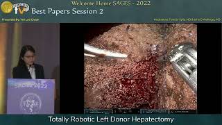 Totally Robotic Left Donor Hepatectomy [upl. by Annatnas]