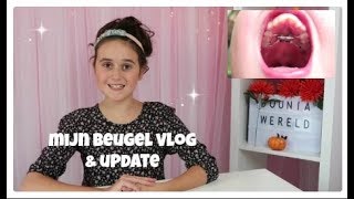 Mijn beugel VLOG  update [upl. by Schnapp988]