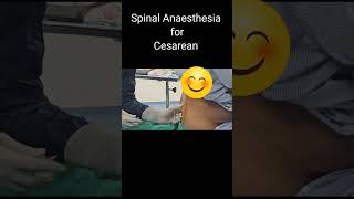 सीजेरियन में कमर में सुई लगाकर कैसे बेहोश करते हैं  Spinal Anaesthesia by Dr Manoj Kathariya [upl. by Varin965]