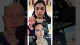 Incredible Botox Result Transformation  Plastic Surgeon Reacts plasticsurgery [upl. by Sweyn]