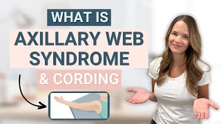 Axillary Web Syndrome or Cording  What is it [upl. by Enovad]