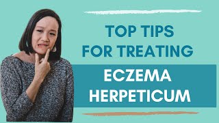 My 5 MustHave Tips for Treating Eczema Herpeticum [upl. by Attiuqram247]