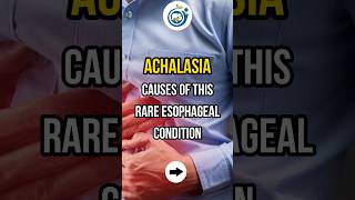 ACHALASIA CAUSES OF THIS RARE ESOPHAGEAL CONDITION shorts achalasia esophagus doctor [upl. by Shipley705]