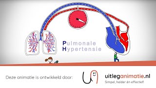 Uitleganimatie  VUmc Pulmonale Hypertensie [upl. by Neehcas]