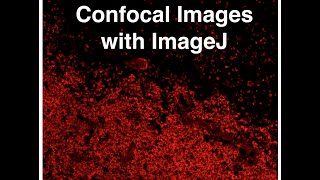 Analyzing Confocal Images with ImageJ [upl. by Martella]