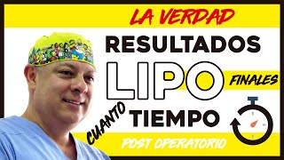 La VERDAD sobre la recuperación de una LIPOSUCCION y los RESULTADOS Lipo lipolaser lipoescultura [upl. by Dahaf]