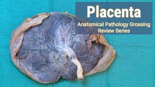 Placenta  Anatomical Pathology Grossing Review Series [upl. by Emina]