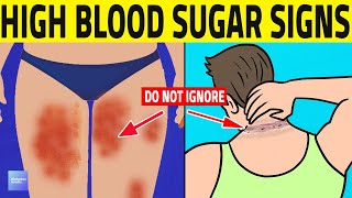 Top 7 Prediabetes Signs You Shouldnt Ignore [upl. by Diann]