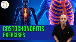 Costochondritis Exercises [upl. by Blus]