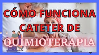 QUIMIOTERAPIA CÓMO FUNCIONA EL CATÉTER [upl. by Ahseirej]