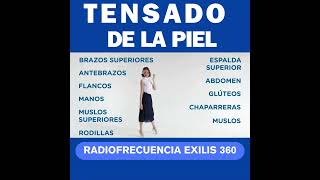 Tensado de Piel con Radiofrecuencia Exilis 360 [upl. by Buzz61]