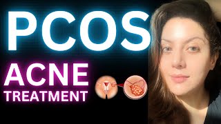 How To Get Rid Of Pcos Cystic Acne Hormonal Acne Treatment [upl. by Miner]