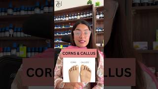 If you have corns on your feet thn you need to watch this doctor callus homoeopathyforall sho [upl. by Millburn153]