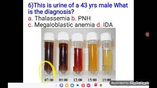 Haematology OSPE Part 2 [upl. by Ecirtam204]