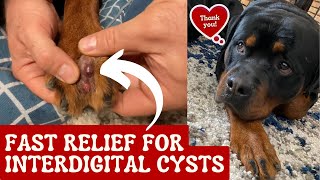 Fast Relief For Interdigital Cysts [upl. by Ettenel899]