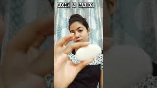 Acnestar Gel and Soap  Remove pimples Acnestar shorts ytshorts skincare acne [upl. by Bruni]