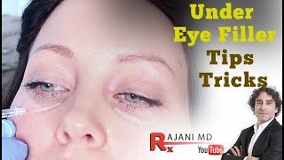 Watch Under Eye FillerTips and Tricks Portland Oregon Restylane Juvederm and PRF Injections [upl. by Nyleahcim]