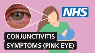 Mayo Clinic Minute What parents need to know about pink eye [upl. by Bittencourt]