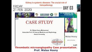 Thrombotic microangiopathy Case presentation prof Walaa Hosny [upl. by Krasner]