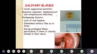 diseases and tumors of the salivary glands [upl. by Harrington664]