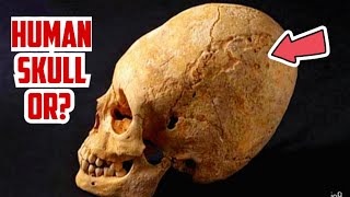 DNA Tests Reveal 3000yearold Paracas Skulls Are Of Unknown Human Race [upl. by Iridissa727]