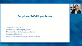 Oncology Today with Dr Neil Love Peripheral TCell Lymphoma Video Lecture [upl. by Introc811]