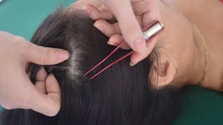 ASMR Scalp Scratching With Tweezer Real Person Hair Parting Hair Play For Relieve Stress Anxiety [upl. by Rudd]