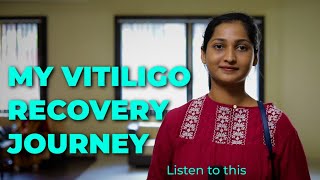 Vitiligo success storiesDr Nitika Kohlivitiligo leucoderma [upl. by Berky]