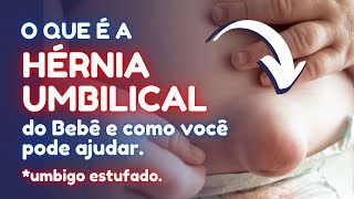 O que é a HÉRNIA UMBILICAL em BEBÊS o umbigo estufado Resolva em casa herniaumbilical bebê [upl. by Welbie]