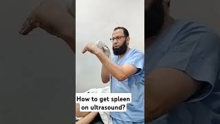 Ultrasound of spleen [upl. by Tilden]