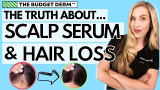 The Truth About Scalp Serums and Hair Loss  The Budget Derm Explains [upl. by Goer]