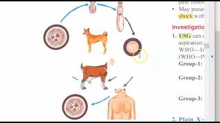 Surgery 530 Hydatid Cyst Liver Echinococcus granulosus Treat PAIR Albendazole brood capsule thrill [upl. by Einotna592]