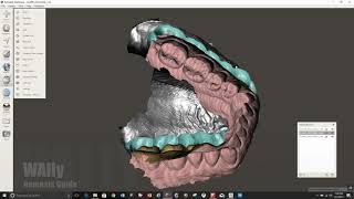 Planmeca Romexis Occlusal Guard [upl. by Meeharb]