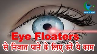 बारबार Eye Floaters की समस्या से हो रहे हैं परेशान तो अपनाएं ये घरेलू उपाय  Eye care Home Remedies [upl. by Ydnam]