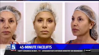 45minute Facelift  8583149244 [upl. by Acillegna28]