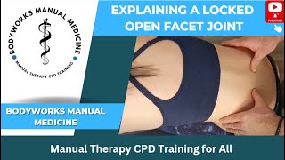 Explaining a Locked Open Lumbar Facet [upl. by Sarson]