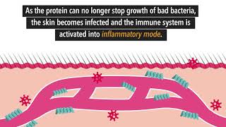 Rosacea Treatment  Causes  Symptoms  Triggers [upl. by Spitzer]