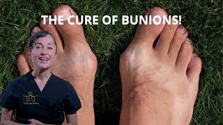 FOOT REFLEXOLOGY 🦶 to CURE BUNIONS [upl. by Gotcher382]