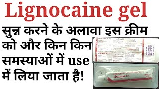 Lignocaine hydrochloride gelintacaine gelxylocaine gel uses benifits side effects in hindi [upl. by Menedez]