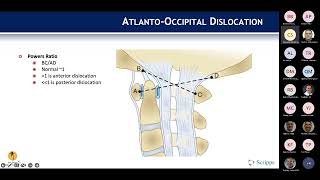 Occipitocervical Trauma presented by Cameron Shirazi MD on October 31 2022 [upl. by Gebelein]